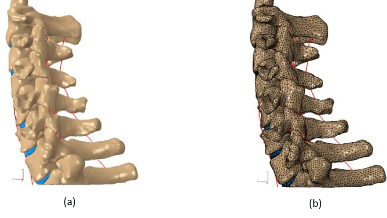 Simulador de marcha humana e modelação de osso em computador