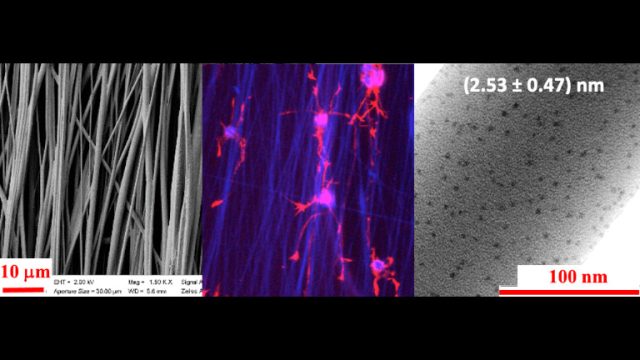 Nanoestruturas para a Engenharia de Tecidos